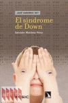 EL SÍNDROME DE DOWN